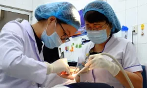 Hơn 86% trẻ em Việt sâu răng